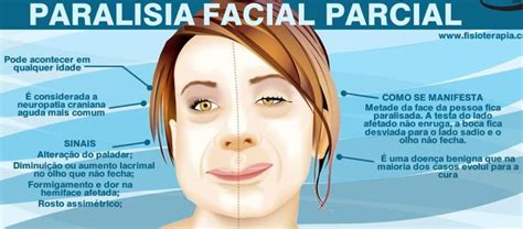 o que causa paralisia no rosto-4